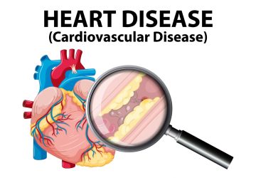 , Understanding Cardiovascular and Stroke Disease Risk in Seniors