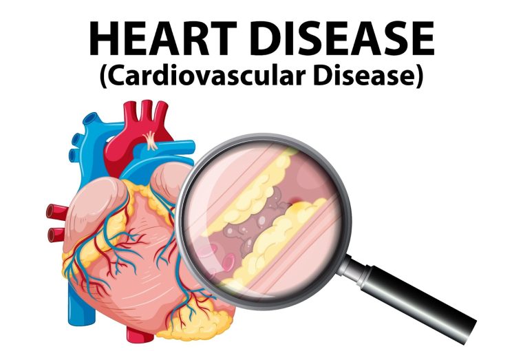 , Understanding Cardiovascular and Stroke Disease Risk in Seniors